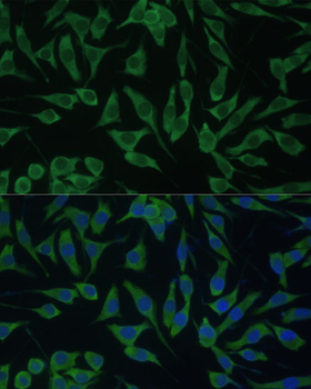 DDX3Y antibody