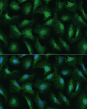 DDX3Y antibody