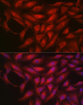 BAX antibody