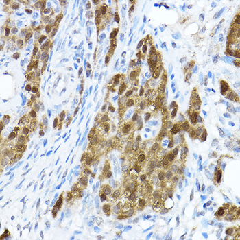 STAT1 antibody