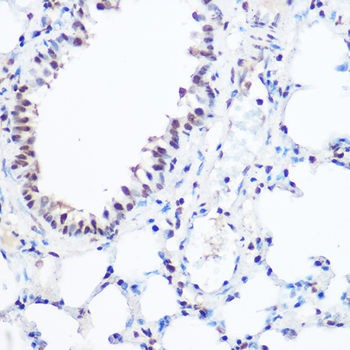 SART3 antibody