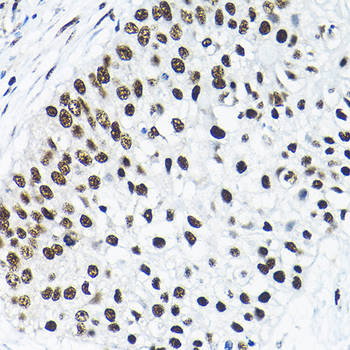 SNRPA1 antibody