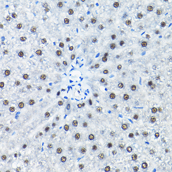 SNRPA1 antibody