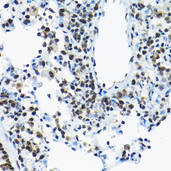 SNRPA1 antibody