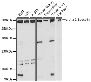 SPTA1 antibody