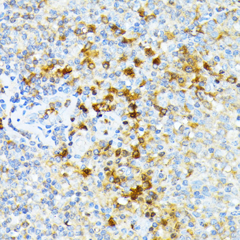 SPTA1 antibody