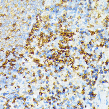 SPTA1 antibody