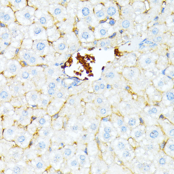 SPTA1 antibody