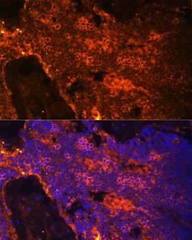 SPTA1 antibody