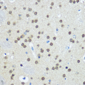 UBA1 antibody