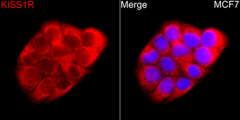 KISS1R antibody