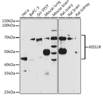 KISS1R antibody