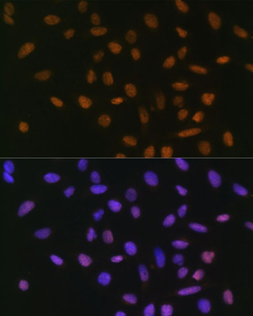 SNAI1 antibody