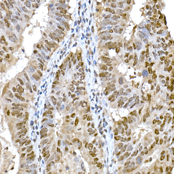 SNAI1 antibody