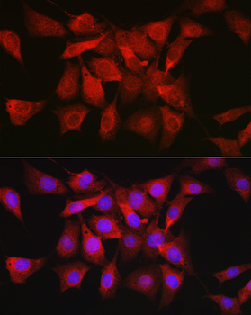 AKT1 antibody