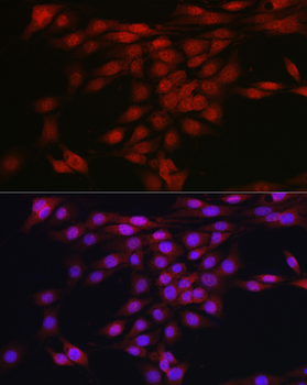 AKT1 antibody