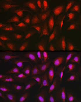 AKT1 antibody