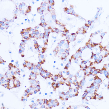 SIRT3 antibody