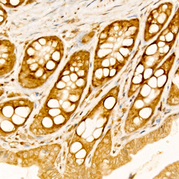 RPS10 antibody