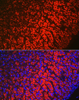 HSD3B1 antibody