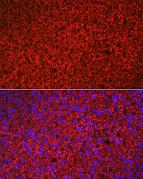 HSD3B1 antibody