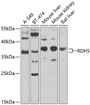 RDH5 antibody