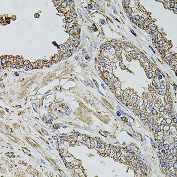 TMC1 antibody