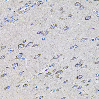 TMC1 antibody