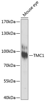 TMC1 antibody