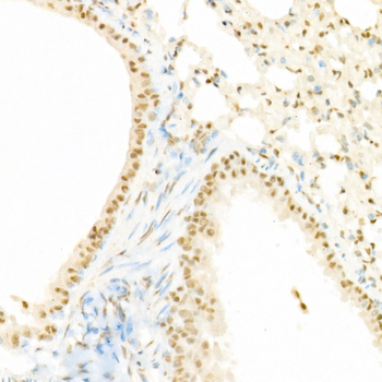 RAF1 (Phospho-pS338) antibody