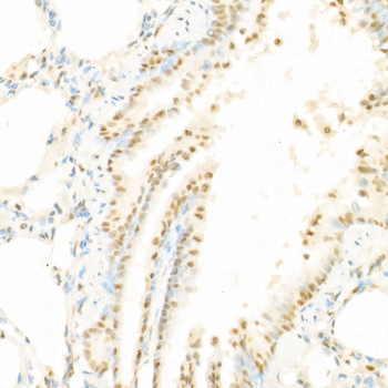 RAF1 (Phospho-pS338) antibody