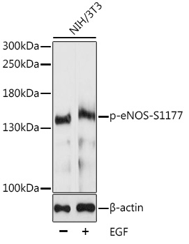 eNOS (Phospho-S1177) antibody