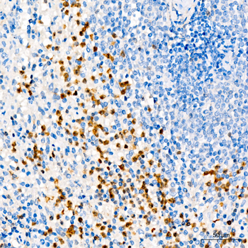 ANXA1 antibody