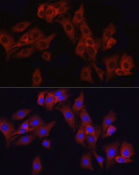 ATF6 antibody