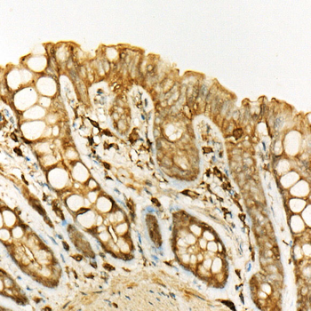 ATF6 antibody