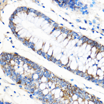 ATG5 antibody