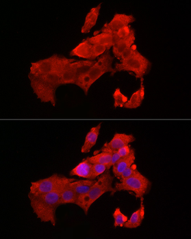 BAX antibody