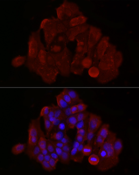 BAX antibody