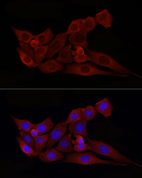 BAX antibody