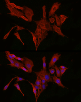 BAX antibody