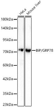 Bip antibody