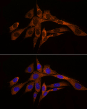 Caspase-8 antibody