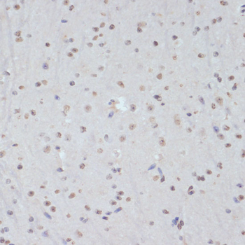 CDK1 (phospho-Y15) antibody