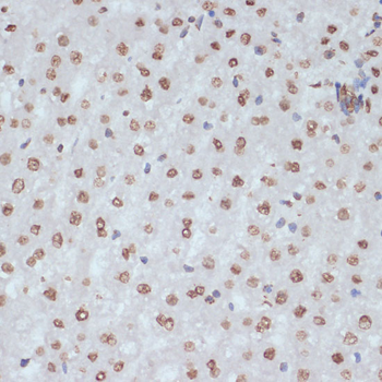 CDK1 (phospho-Y15) antibody