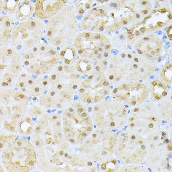 CSNK2A1 antibody