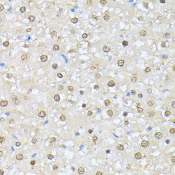 CSNK2A1 antibody