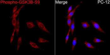 GSK3 (phospho-S9) antibody