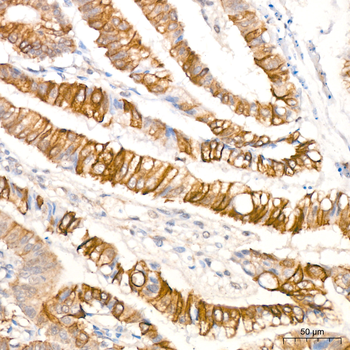 GSK3 (phospho-S9) antibody