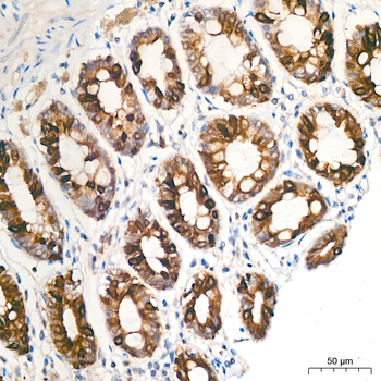 GSK3 (phospho-S9) antibody