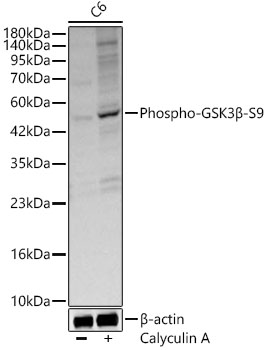 GSK3 (phospho-S9) antibody